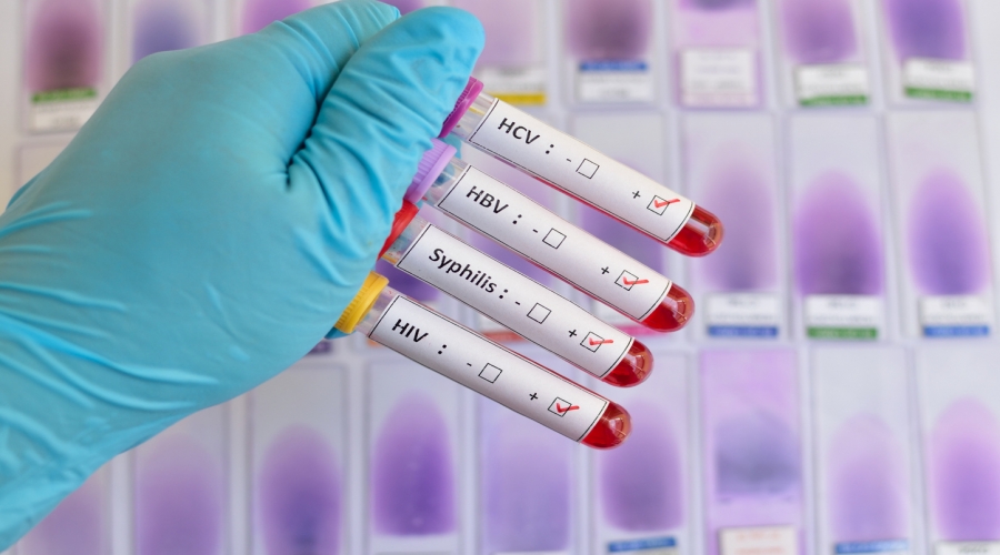 LES MALADIES SEXUELLEMENT TRANSMISSIBLES